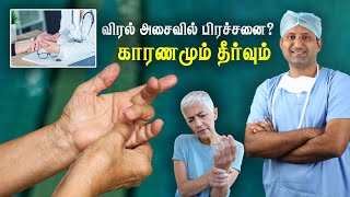 விரல்களில் வலி விரல் இருக்கம் வர காரணமும் தீர்வும்  Trigger Finger  tamil  Dr Jeya Venkatesh [upl. by Yerffoj4]