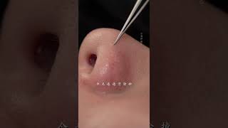 she came to quotcomfortquot her skin immersiveskincare blackheads asmr skinmanagement facialspa [upl. by Nivrehs]