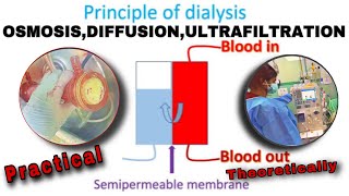 Principle of Hemodialysis  How Dialysis Works [upl. by Myer417]