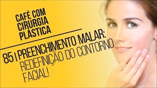 85 Preenchimento Malar Redefinição do Contorno Facial  Café com Cirurgia Plástica [upl. by Kolk]