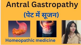 Antral Gastropathy पेट में सूजन treatment  Antral gastritis symptomscause amp homeopathic medicine [upl. by Enihpets]