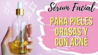 🤩 CÓMO HACER SÉRUM HIDRATANTE PARA PIEL GRASA Y CON ACNÉ 🤯 [upl. by Royden]