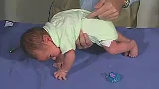 324  Primitve Reflexes Galant Reflex  Newborn Normal  Infant Clinical ExaminationMRCP [upl. by Nowyt]