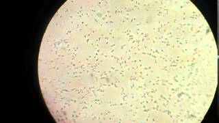 Sperm cells in microscope [upl. by Chae657]