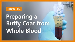 Preparing a Buffy Coat from Whole Blood [upl. by Oicneconi]