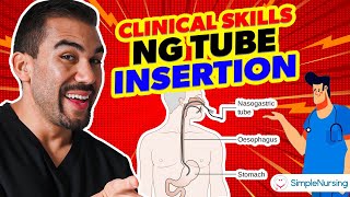 Master NG Tube Insertion A StepbyStep Clinical Skills Guide for Nurses [upl. by Anirec]