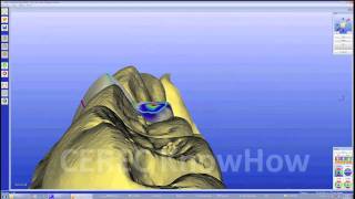 CEREC® Crown Biogeneric Reference  Crown  Software [upl. by Lamberto422]