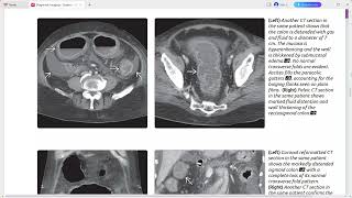 COLON DIAGNOSTIC IMAGING SERIES [upl. by Ylak]