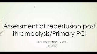 Assessment of reperfusion post fibrinolysisPrimary PCI [upl. by Edward662]