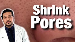 How to Shrink Pores For Good  Get Rid of Pores on Nose FAST 2021 [upl. by Story997]