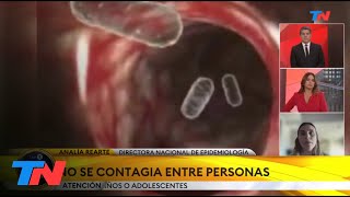 LEGIONELLA quotEs una bacteria que está en el aguaquot Su mortalidad es del 80 en pacientes de riesgo [upl. by Yotal]