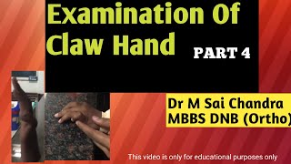 Examination Of Claw Hand [upl. by Lomaj]