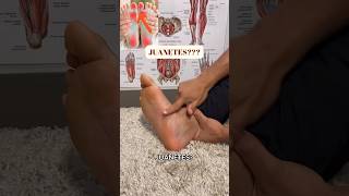 JUANETES en el pié❓HAZ ESTO‼️bunions footpain [upl. by Esenwahs]