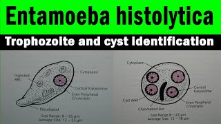 Entamoeba histolytica trophozoite and cyst  microscopic view with identification features [upl. by Adyaj]