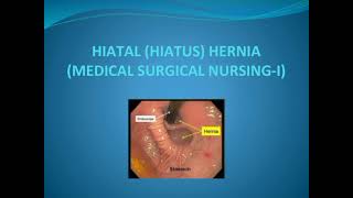 Hiatal Hernia [upl. by Braun]