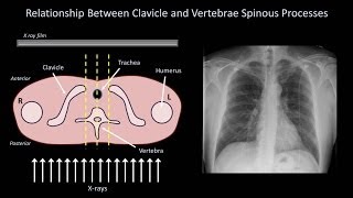 How to Interpret a Chest XRay Lesson 3  Assessing Technical Quality [upl. by Isola]