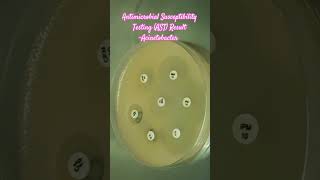 Antibiotics Sensitivity Testing AST of Acinetobacter baumannii complex microbiology microbes [upl. by Oderfigis]