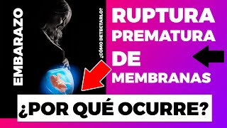 La Ruptura Prematura De Membranas [upl. by Maryrose665]