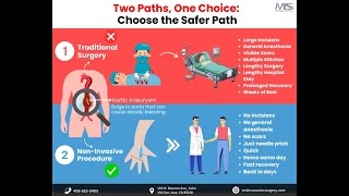 Aortic Aneurysm Two Paths One Choice [upl. by Chaing]