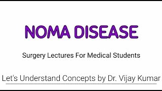 Noma Disease  Cancrum Oris  Gangrenous Stomatitis  Surgery Lectures [upl. by Lerred]