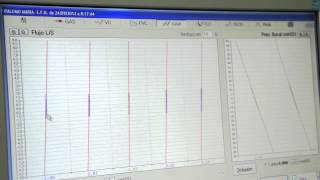 Volúmenes Pulmonares por Pletismografía corporal Prueba [upl. by Roderich988]