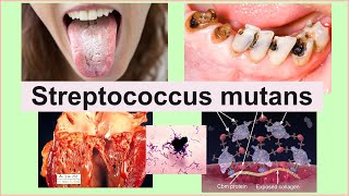 Streptococcus mutans [upl. by Ameekahs]