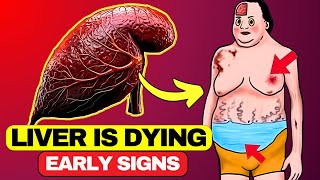 Is Your Liver Dying 17 Critical Symptoms You Must Know  HealthQuest [upl. by Akcirre]