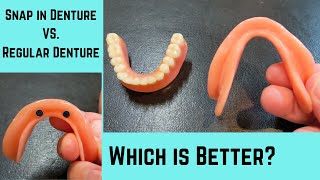 Why a lower snap in denture is better than a lower regular denture [upl. by Kamal147]