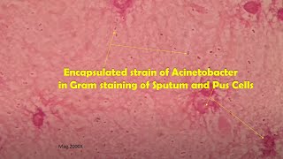 Acinetobacter in clinical sample Sputum Gram stain Microscopy at various magnifications [upl. by Adnac]