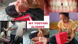 My Toothsi Aligner Day 1Unboxing of Toothsi AlignerBraces Precaution in IndiaToothsi [upl. by Tobie859]