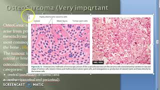 Pathology 828 a OsteoSarcoma OsteoGenic Bone Tumor Metaphysis Malignancy surface [upl. by Stromberg]