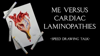 Me vs cardiac laminopathies [upl. by Annirak]