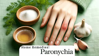 Get Rid of Painful Paronychia Naturally Home Remedies [upl. by Alsi]