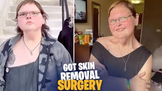 Did Tammy Slaton Get Skin Removal Surgery Fans Speculate on 1000lb Sisters Star’s Next Step [upl. by Neelloj834]