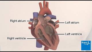 Supraventricular Tachycardia  ECG interpretation [upl. by Townshend]