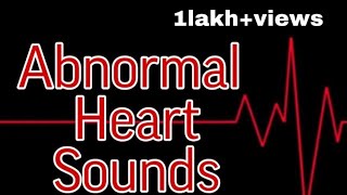 Abnormal Heart Sounds  MisMedicine [upl. by Naelcm672]