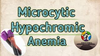 Microcytic Hypochromic Anemia in hindi ll ANEMIA ll Hematology And Blood Banking [upl. by Bremser]