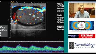 Ultrasound of Acute Epididymo Orchitis by Dr Arjun Kalyanpur [upl. by Irpak605]