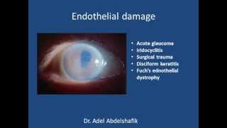 Cornea  1 anatomy [upl. by Anamor]