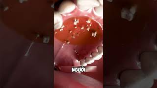 Hyperdontia bạn đã biết chưa dentist facts nhakhoa teeth [upl. by Jumbala280]