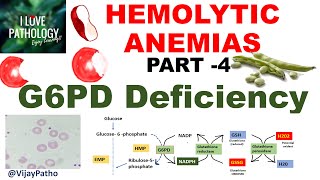 Hemolytic Anemias Part 4 G6PD Deficiency PathophysiologyMorphology clinical features [upl. by Halsted]