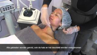 Micro Needling treatment [upl. by Gonta]