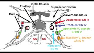 Cavernous Sinus Anatomy amp Cavernous Sinus Syndrome [upl. by Izaak]