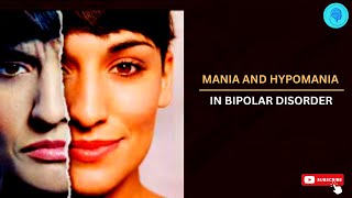 Mania and Hypomania in Bipolar Disorder [upl. by Marcoux]