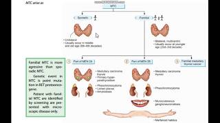 Thyroid cancer  Follicualr and Medullary [upl. by Neyrb]