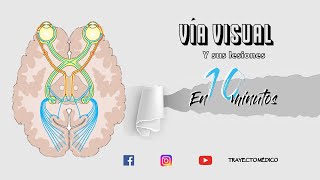 VÍA VISUAL y sus lesiones en 10 MINUTOS [upl. by Loziram772]