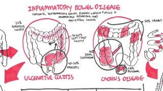 Inflammatory Bowel Disease  Crohns and Ulcerative Colitits [upl. by Ained]