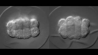 Developing bryozoan embryos animal views [upl. by Norven789]