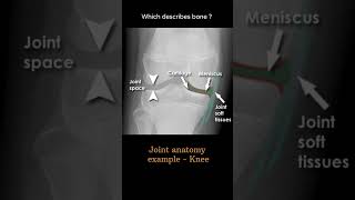 Joint anatomy example knee 4 Musculoskeletal Xray Joint anatomy radiologychannel007 [upl. by Naillimxam]