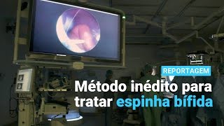 USP  Método inédito para tratar espinha bífida [upl. by Peta931]